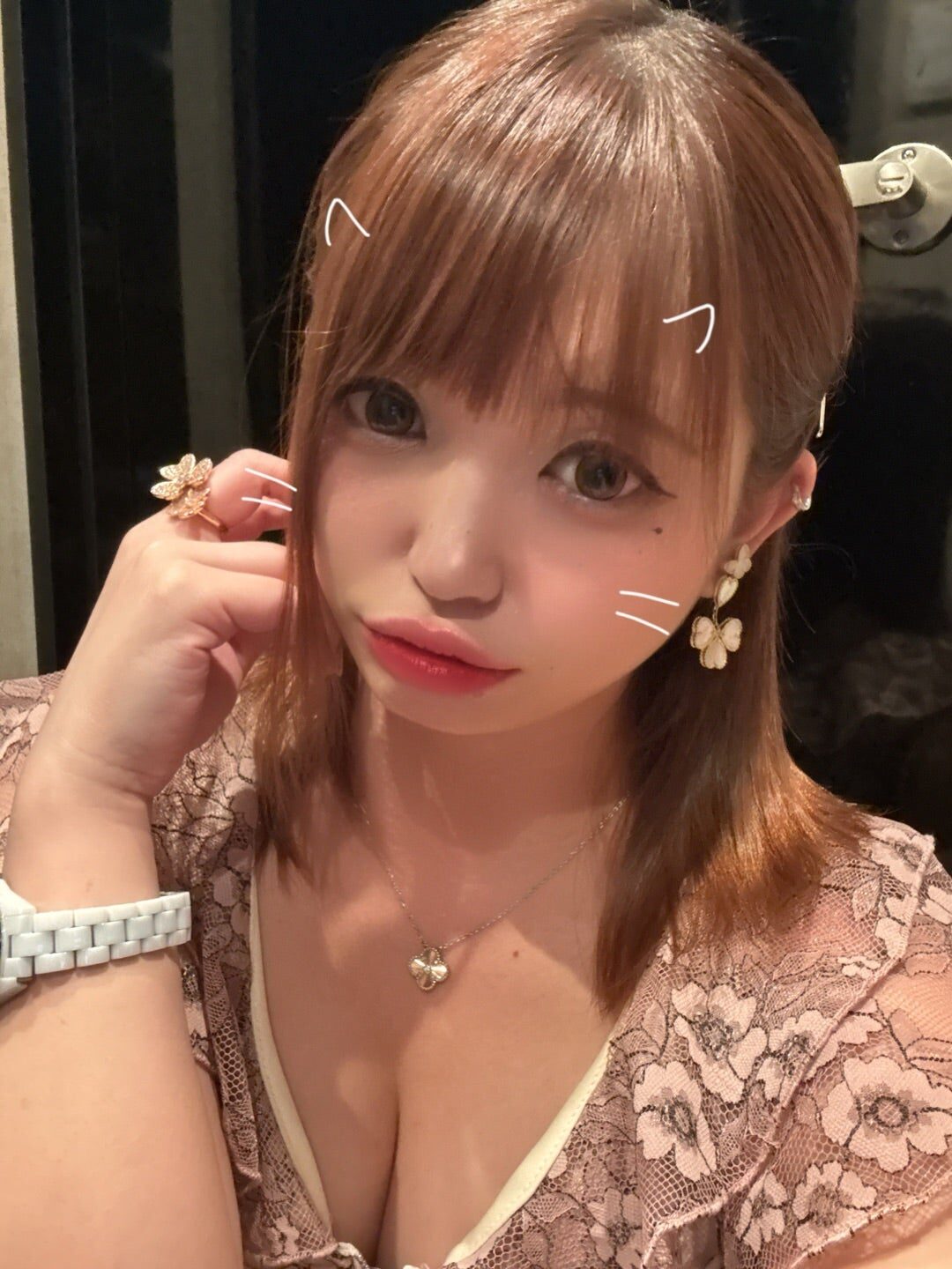 急遽