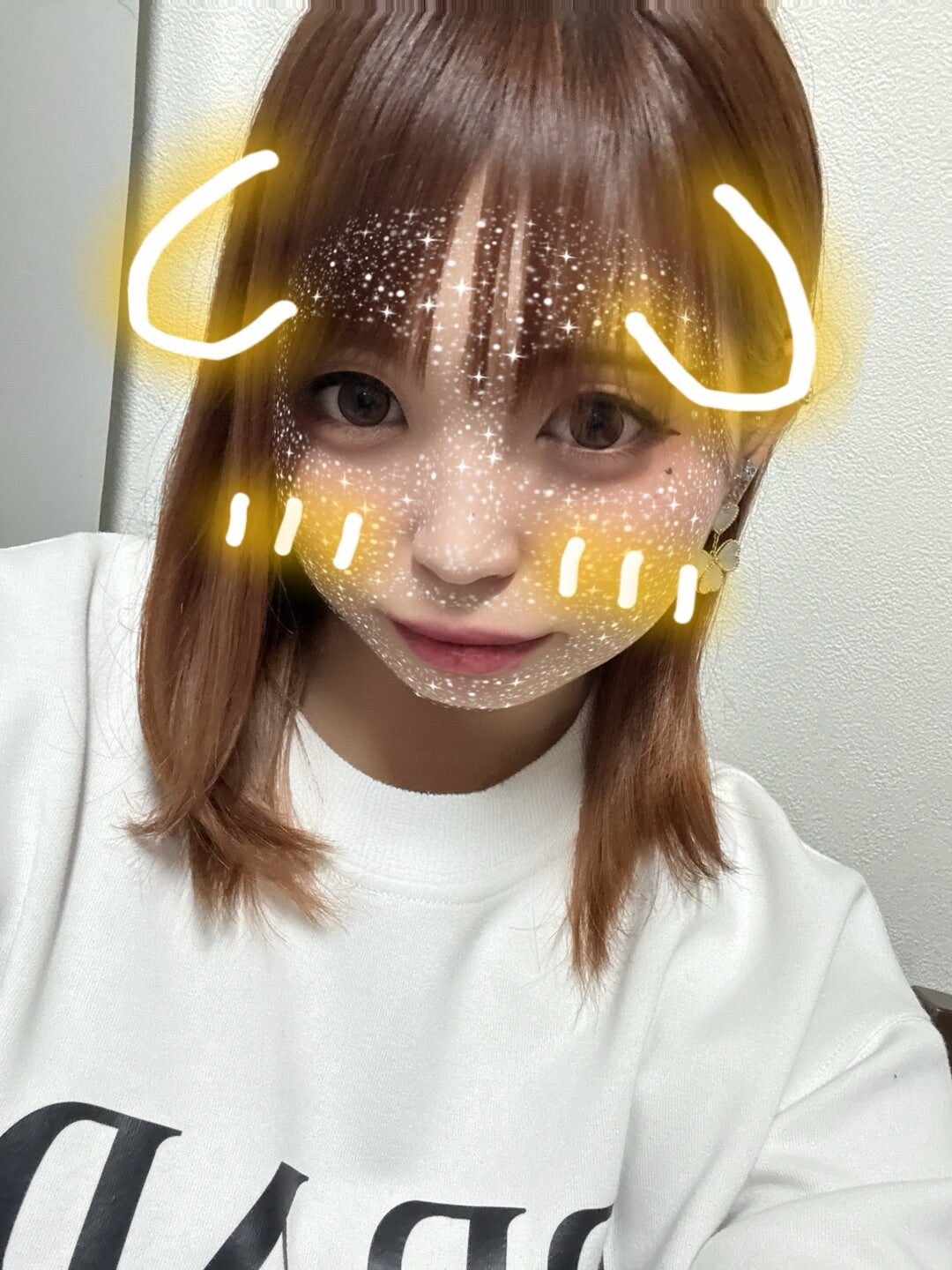 二日酔い