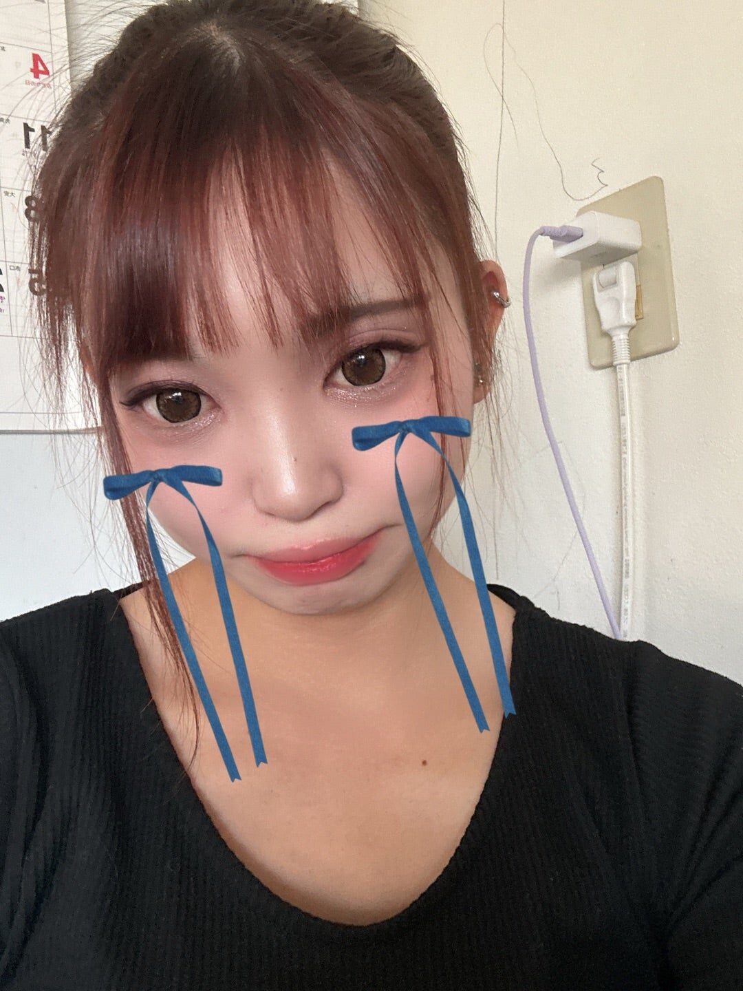 寒暖差アレルギー