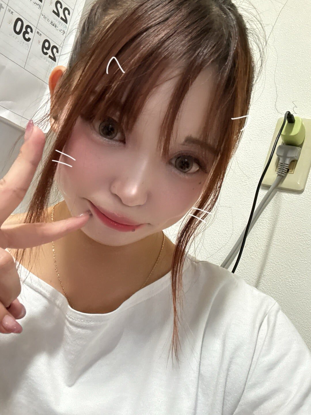 疲労